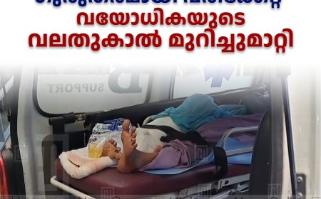 നെടുങ്കണ്ടത്ത് ബസിന്റെ ചക്രം കയറിയിറങ്ങി ഗുരുതരമായി പരിക്കേറ്റ വയോധികയുടെ വലതുകാല്‍ മുറിച്ചുമാറ്റി