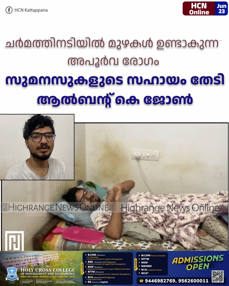 ചര്മത്തിനടിയില് മുഴകള് ഉണ്ടാകുന്ന അപൂര്വ രോഗം: സുമനസുകളുടെ സഹായം തേടി ആല്ബന്റ് കെ ജോണ്