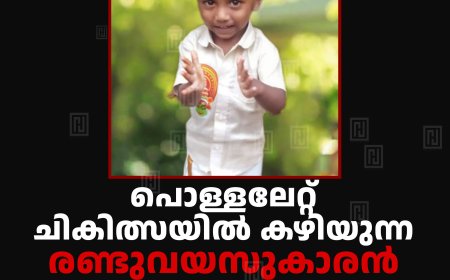 പൊള്ളലേറ്റ് ചികിത്സയില്‍ കഴിയുന്ന രണ്ടുവയസുകാരന്‍ സുമനസുകളുടെ സഹായം തേടുന്നു 