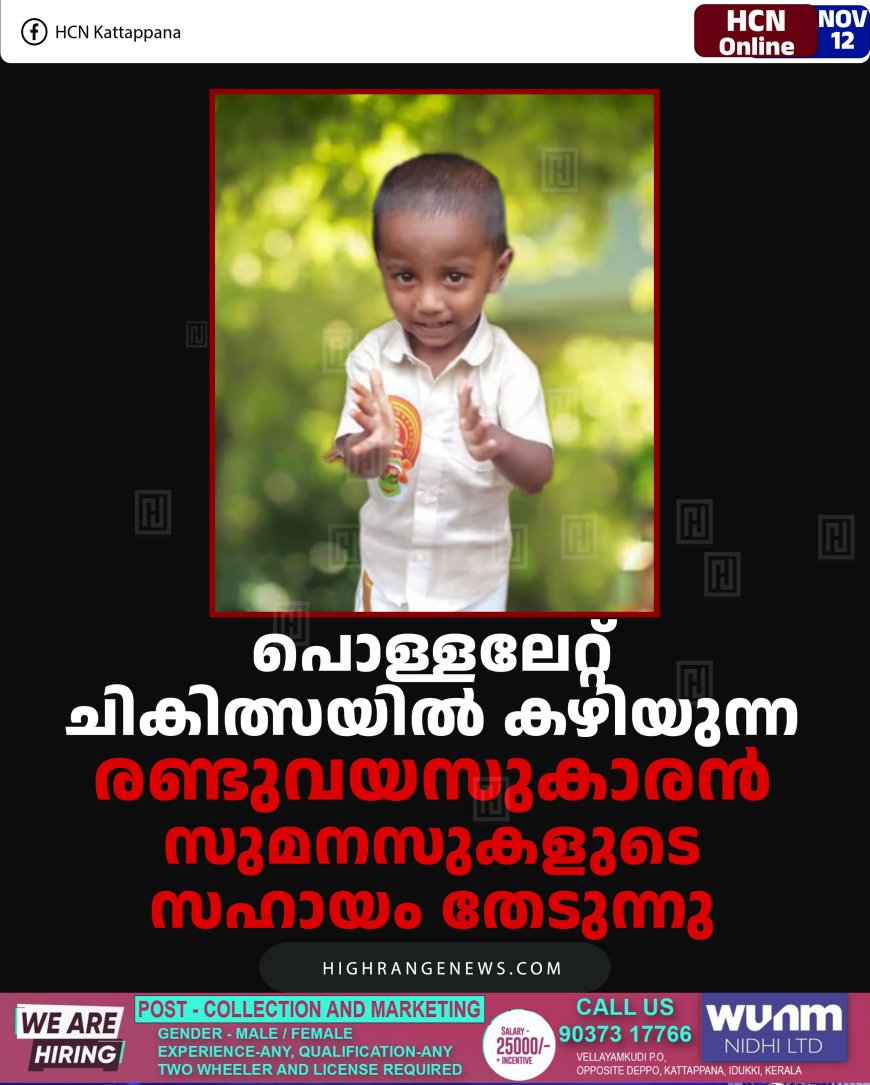 പൊള്ളലേറ്റ് ചികിത്സയില്‍ കഴിയുന്ന രണ്ടുവയസുകാരന്‍ സുമനസുകളുടെ സഹായം തേടുന്നു 