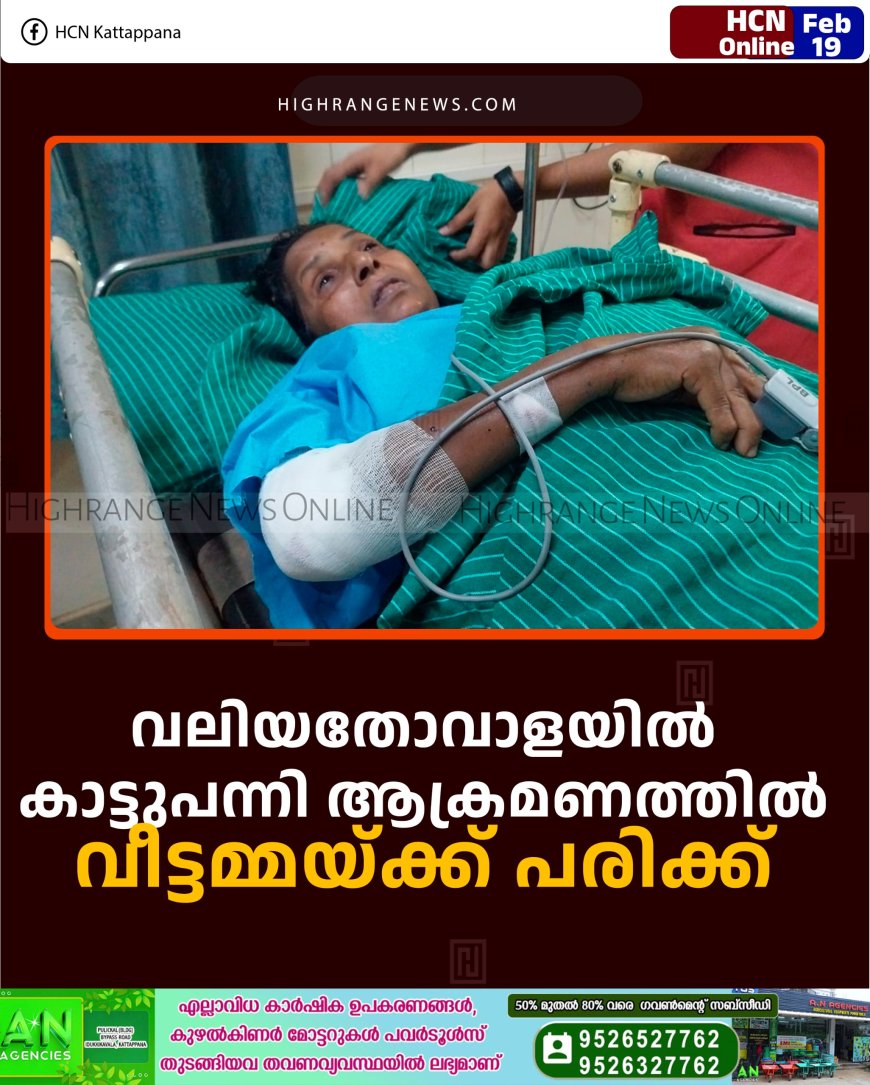 വലിയതോവാളയില്‍ കാട്ടുപന്നി ആക്രമണത്തില്‍ വീട്ടമ്മയ്ക്ക് പരിക്ക് 