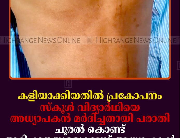 കളിയാക്കിയതില്‍ പ്രകോപനം: സ്‌കൂള്‍ വിദ്യാര്‍ഥിയെ അധ്യാപകന്‍ മര്‍ദിച്ചതായി പരാതി: ചൂരല്‍ കൊണ്ട് അടിച്ചതേയുള്ളൂവെന്ന് അധ്യാപകന്‍
