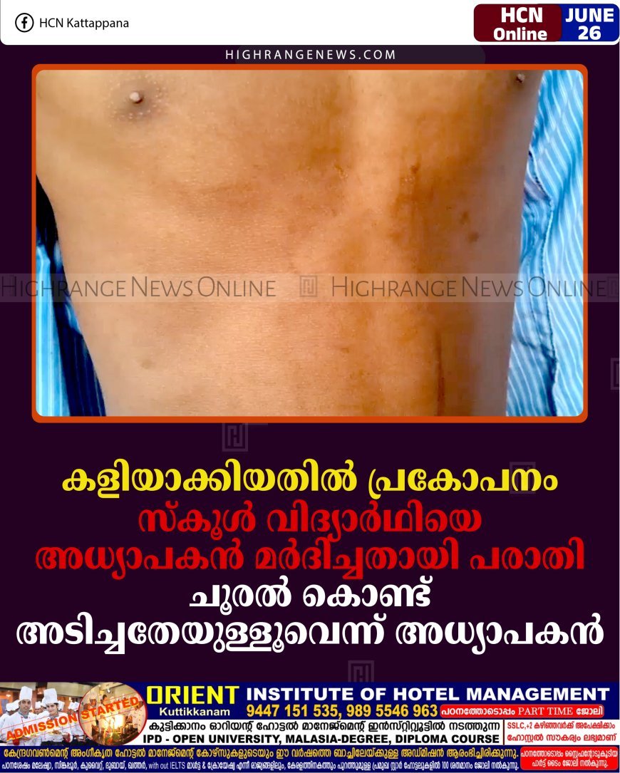 കളിയാക്കിയതില്‍ പ്രകോപനം: സ്‌കൂള്‍ വിദ്യാര്‍ഥിയെ അധ്യാപകന്‍ മര്‍ദിച്ചതായി പരാതി: ചൂരല്‍ കൊണ്ട് അടിച്ചതേയുള്ളൂവെന്ന് അധ്യാപകന്‍