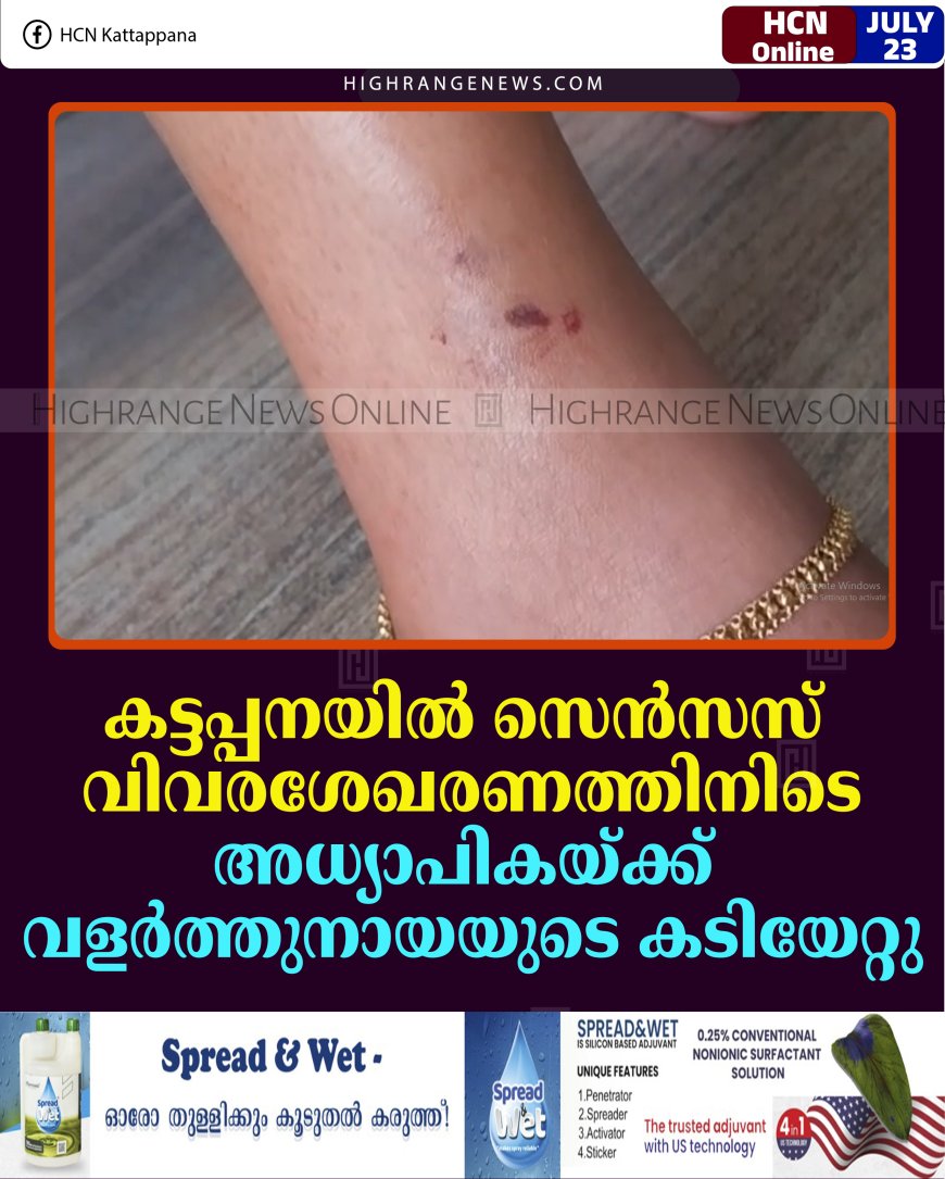 കട്ടപ്പനയില്‍ സെന്‍സസ് വിവരശേഖരണത്തിനിടെ അധ്യാപികയ്ക്ക് വളര്‍ത്തുനായയുടെ കടിയേറ്റു